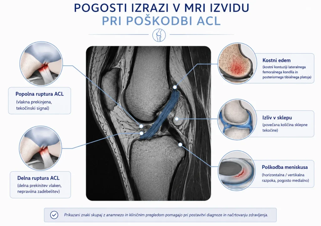 Najpogostejši izrazi v MRI izvidu pri poškodbi ACL